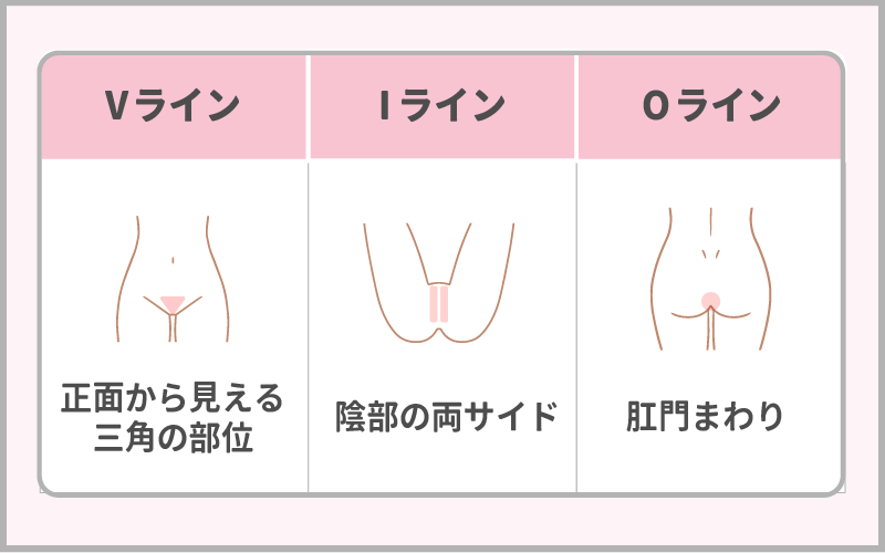 VIO脱毛とは？「Vライン」「Iライン」「Oライン」ってどこのこと？