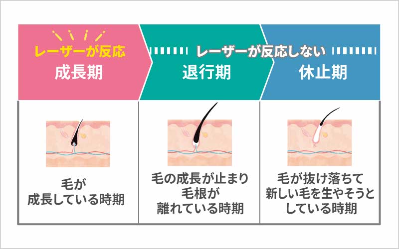 医療脱毛　毛周期