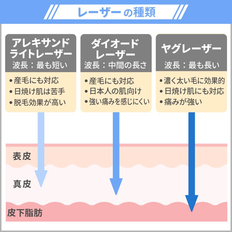 医療脱毛　レーザー